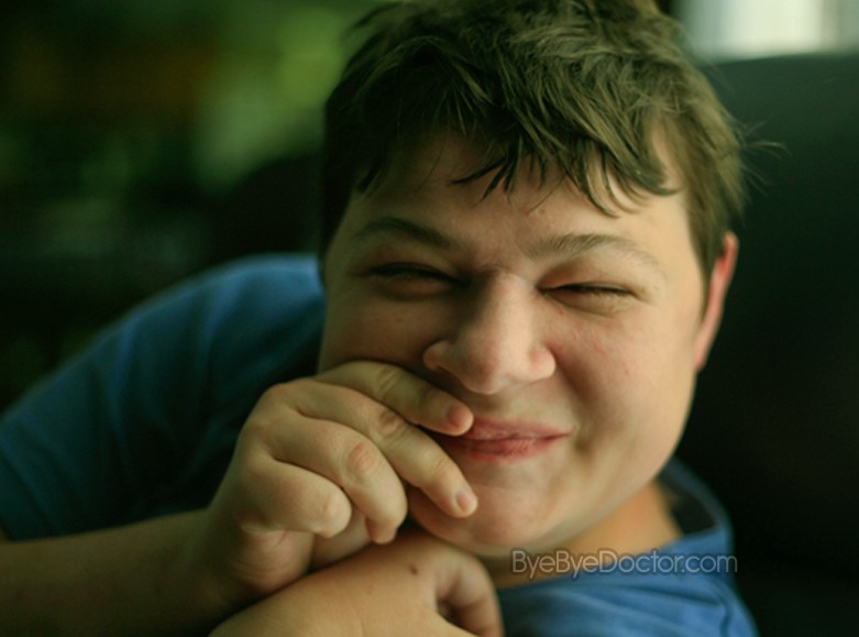 angelman syndrome pictures