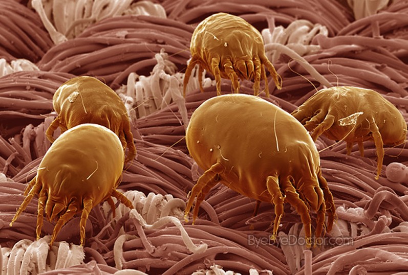 dust mites pictures